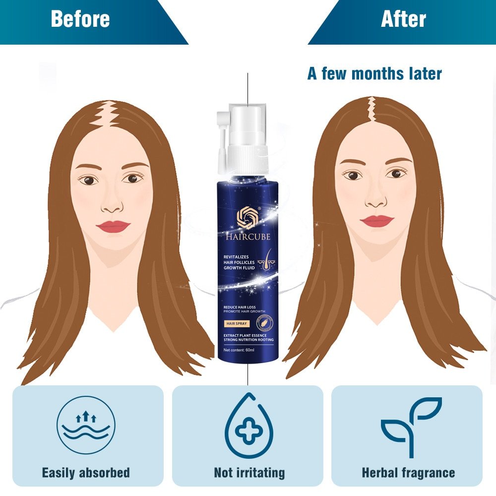 Fast Hair Growth Essence Natural Herbal Health Treatment Hair Loss Makes Hair Growth Longer and Thicker Hair Care Products 60ml - Image 2