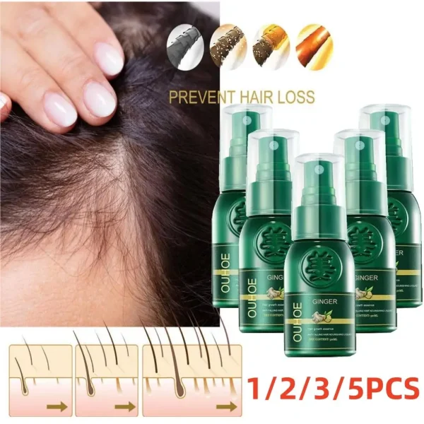 1/2/3/5PCS Ginger Spray Products Natural Prevent Baldness Treatment Fast Grows Nourish Damaged Hair Care