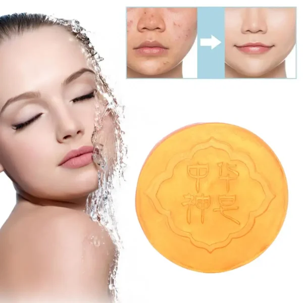 Body Whitening Soap Deep Clean Skin Chicken Skin Removal Underarm Knees Care White Armpit Body Products Brighten Bleaching X3A0
