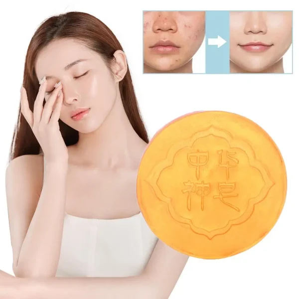 Body Whitening Soap Deep Clean Skin Chicken Skin Removal White Brighten Bleaching Products Knees Care Soap Body Armpit Unde P4X0
