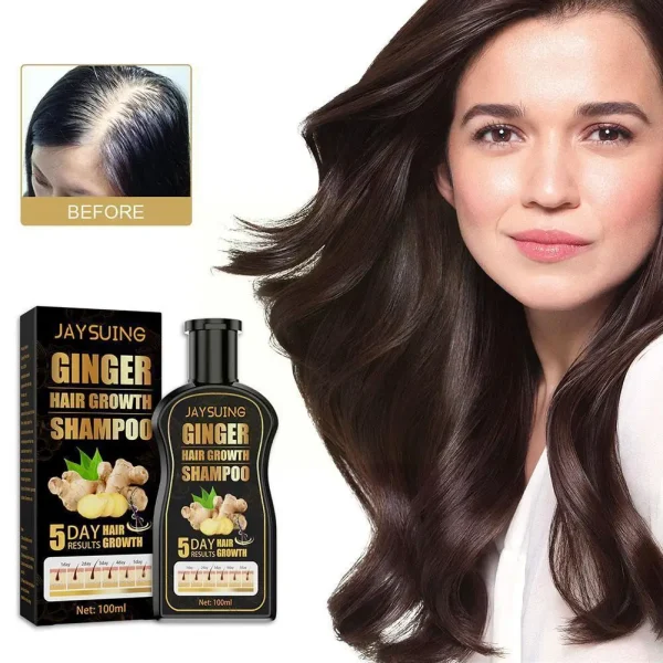 Hair Shampoo For Hair Growth And Hair Loss Prevents Scalp Treatments Thinning Hair For Men And Women 100ml V3c5