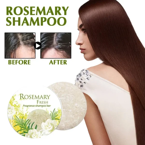 Rosemary Shampoo Soap| Repair Damaged Beauty Hair Care Prevent Hair Loss Serum Scalp Solution For Men Women J1E2