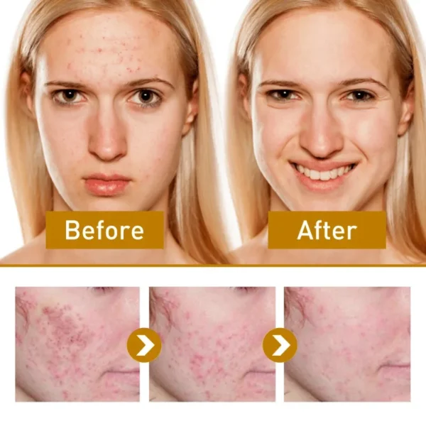 Facial Fade Spots Papaya Cream Anti-aging Brighten Skin Tone Day Cream Moisturiz Skin Improve Dark Spots Fine Lines Night Cream - Image 2