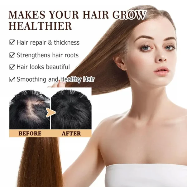Rice Dense Hair Spray Rice Water Spray Serum Snti-Hair Loss Seborrheic Hair Loss Repair Rice Shampoo For Men Women - Image 3